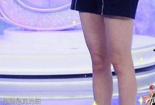 明星的腿是抽脂的么,抽脂还是天生的？